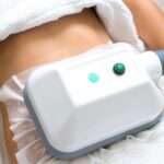 The Coolsculpting Revolution – Freezing Away Fat for a Sculpted Silhouette