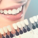 What to Keep in Mind When Meeting Your Dentist