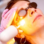 Yellow Laser Treatments for Clear, Even Skin