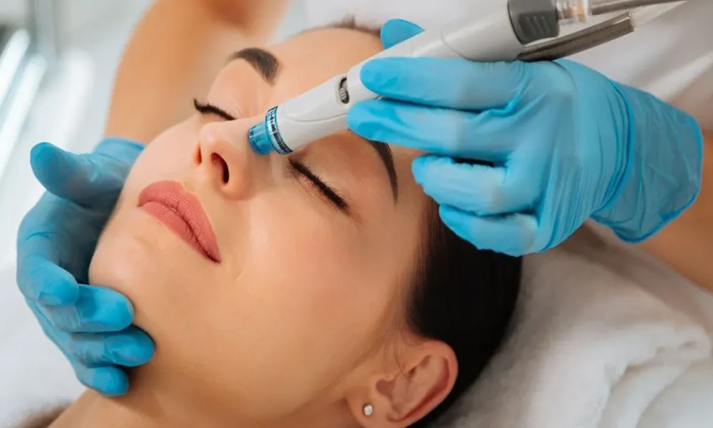 Why Laser Skin Treatment Is Transforming the Way People Approach Skincare